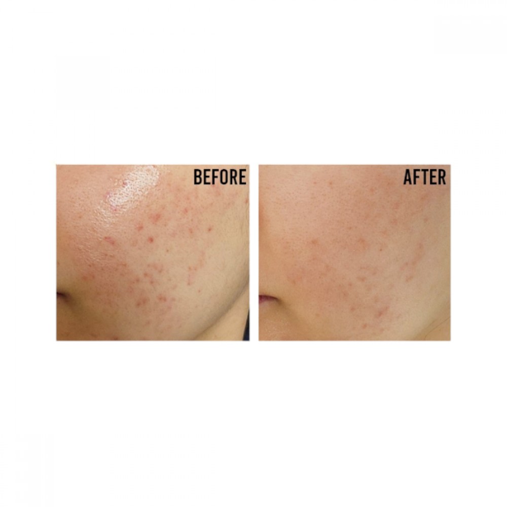 BEAUTY OF JOSEON - Relief Sun : Rice + Probiotic SPF50+ PA++++-50ml - Image 2